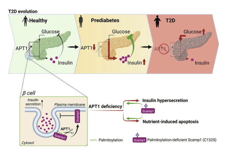Protein palmitoylation helps to model the evolution of some forms of type 2 diabetes 